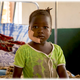 injured little girl in Rotifunk Hospital, Sierra Leone